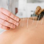 Acupuncture for High Blood Pressure : Does it Help?
